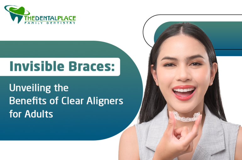 Invisible Braces: Unveiling the Benefits of Clear Aligners for Adults ...